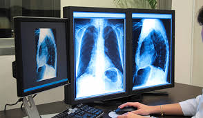 Diploma in X Ray Technology